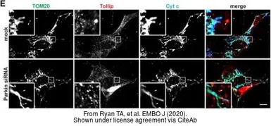 Anti-Tollip antibody [N2C3] used in Immunocytochemistry/ Immunofluorescence (ICC/IF). GTX116566