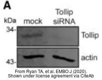 Anti-Tollip antibody [N2C3] used in Western Blot (WB). GTX116566