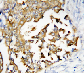 Anti-Presenilin 2 antibody used in IHC (Paraffin sections) (IHC-P). GTX11661