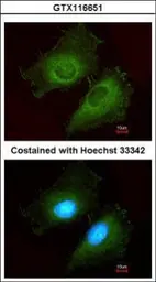 Anti-AKR1B10 antibody [N3C3] used in Immunocytochemistry/ Immunofluorescence (ICC/IF). GTX116651