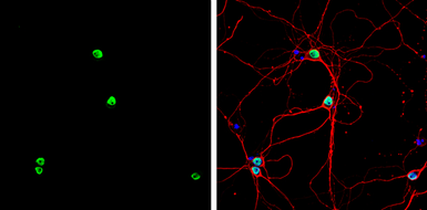 Anti-PTBP2 antibody used in Immunocytochemistry/ Immunofluorescence (ICC/IF). GTX116704