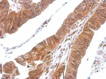 Anti-CXCL16 antibody used in IHC (Paraffin sections) (IHC-P). GTX116706