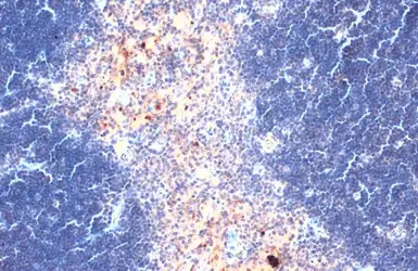 Anti-CXCL16 antibody used in IHC (Paraffin sections) (IHC-P). GTX116706