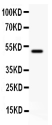 Anti-CD80 antibody used in Western Blot (WB). GTX11680