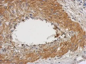 Anti-NUAK2 antibody used in IHC (Paraffin sections) (IHC-P). GTX116909