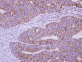 Anti-Phospholipase A2 XIIA antibody [N1C3] used in IHC (Paraffin sections) (IHC-P). GTX117089