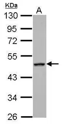 Anti-RGS6 antibody used in Western Blot (WB). GTX117121