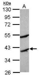 Anti-MOGAT2 antibody used in Western Blot (WB). GTX117145