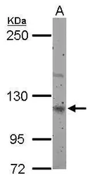 Anti-Munc 13-4 antibody [N1N2], N-term used in Western Blot (WB). GTX117155