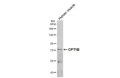 Anti-CPT1B antibody [C1C2], Internal used in Western Blot (WB). GTX117231