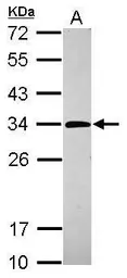 Anti-Purine nucleoside phosphorylase antibody used in Western Blot (WB). GTX117364