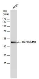 Anti-TMPRSS11D antibody used in Western Blot (WB). GTX117370