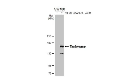 Anti-Tankyrase antibody used in Western Blot (WB). GTX117417