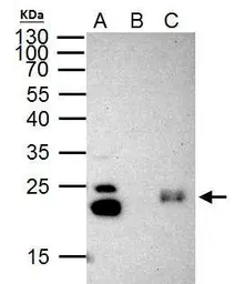 Anti-HP1 gamma antibody used in Immunoprecipitation (IP). GTX117561