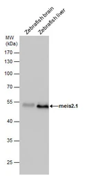 Anti-MEIS2 antibody used in Western Blot (WB). GTX117564