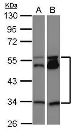 Anti-MEIS2 antibody used in Western Blot (WB). GTX117564