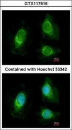 Anti-RRP4 antibody [N1C3] used in Immunocytochemistry/ Immunofluorescence (ICC/IF). GTX117616