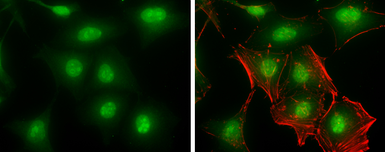 Anti-PNMA2 antibody used in Immunocytochemistry/ Immunofluorescence (ICC/IF). GTX117650