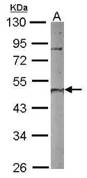 Anti-PNMA2 antibody used in Western Blot (WB). GTX117650