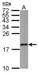 Anti-MMS2 antibody used in Western Blot (WB). GTX117707