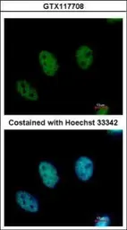 Anti-CDYL antibody used in Immunocytochemistry/ Immunofluorescence (ICC/IF). GTX117708