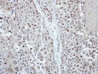 Anti-CDYL antibody used in IHC (Paraffin sections) (IHC-P). GTX117708
