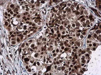 Anti-GPKOW antibody [N3C3] used in IHC (Paraffin sections) (IHC-P). GTX117716