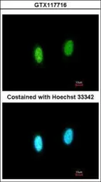 Anti-GPKOW antibody [N3C3] used in Immunocytochemistry/ Immunofluorescence (ICC/IF). GTX117716