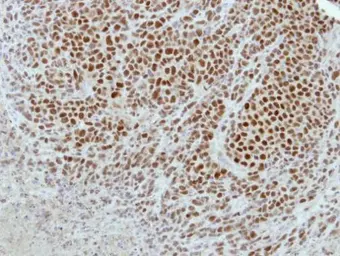 Anti-GPKOW antibody [N3C3] used in IHC (Paraffin sections) (IHC-P). GTX117716