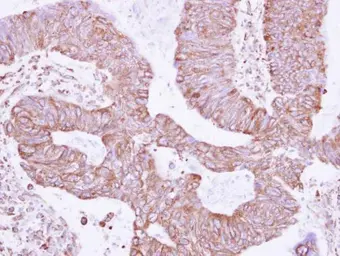 Anti-RNF181 antibody used in IHC (Paraffin sections) (IHC-P). GTX117747