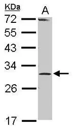 Anti-RPP30 antibody [N1C3] used in Western Blot (WB). GTX117754