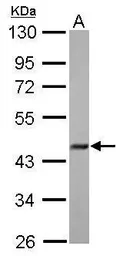 Anti-FBXO22 antibody [N3C3] used in Western Blot (WB). GTX117774