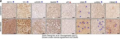 Anti-MCTS1 antibody [N1C3] used in Immunohistochemistry (IHC). GTX117793