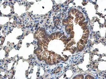 Anti-MCTS1 antibody [N1C3] used in IHC (Paraffin sections) (IHC-P). GTX117793