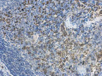 Anti-MCTS1 antibody [N1C3] used in IHC (Paraffin sections) (IHC-P). GTX117793