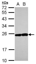 Anti-RAB17 antibody [N1C3] used in Western Blot (WB). GTX117846