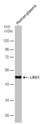 Anti-LRG1 antibody used in Western Blot (WB). GTX117875