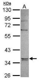 Anti-GPD1 antibody used in Western Blot (WB). GTX117910