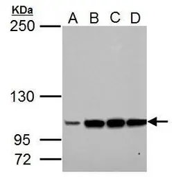 Anti-LRIG3 antibody used in Western Blot (WB). GTX117929