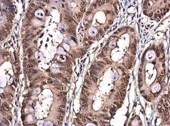 Anti-EIF6 antibody [N1C3-2] used in IHC (Paraffin sections) (IHC-P). GTX117971