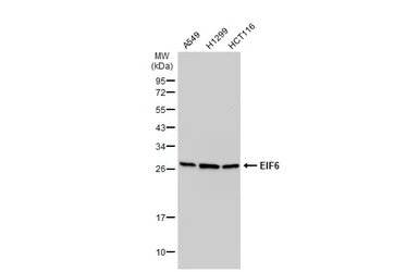 Anti-EIF6 antibody [N1C3-2] used in Western Blot (WB). GTX117971
