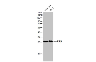 Anti-EIF6 antibody [N1C3-2] used in Western Blot (WB). GTX117971