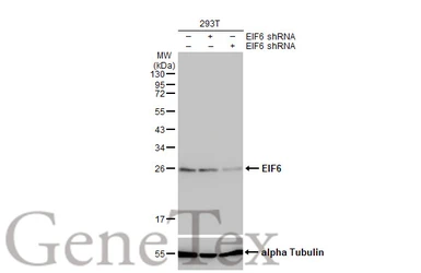 Anti-EIF6 antibody [N1C3-2] used in Western Blot (WB). GTX117971