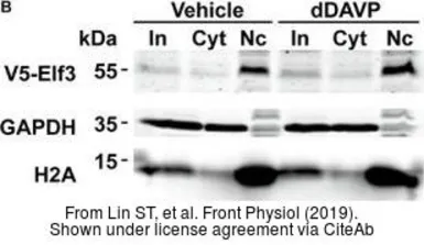 Anti-V5 tag antibody used in Western Blot (WB). GTX117997