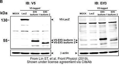 Anti-V5 tag antibody used in Western Blot (WB). GTX117997
