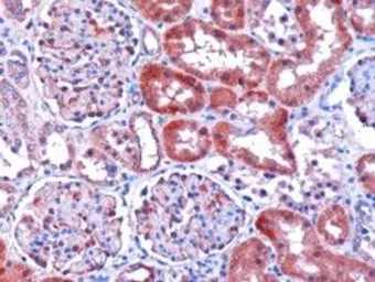 Anti-DCXR antibody, C-term used in IHC (Paraffin sections) (IHC-P). GTX11800