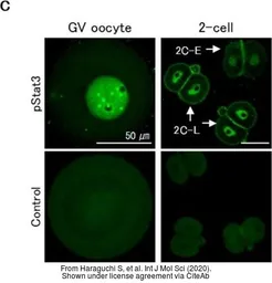 Anti-STAT3 (phospho Tyr705) antibody used in Immunocytochemistry/ Immunofluorescence (ICC/IF). GTX118000