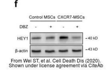 Anti-HEY1 antibody used in Western Blot (WB). GTX118007