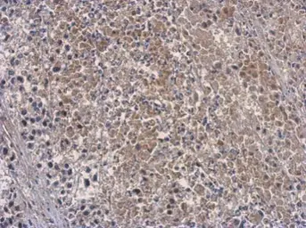 Anti-OAS3 antibody used in IHC (Paraffin sections) (IHC-P). GTX118059