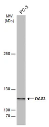 Anti-OAS3 antibody used in Western Blot (WB). GTX118059